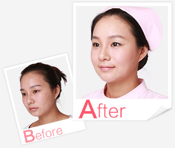 產(chǎn)后恢復(fù)