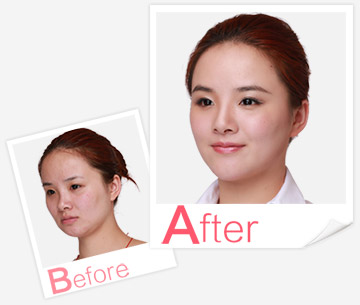 產(chǎn)后康復(fù)