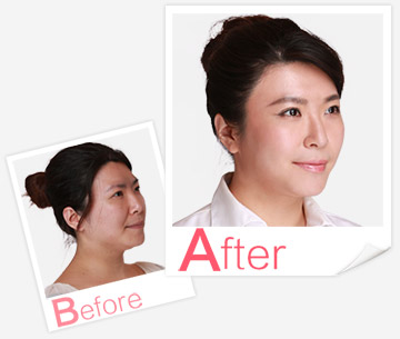 產(chǎn)后康復(fù)