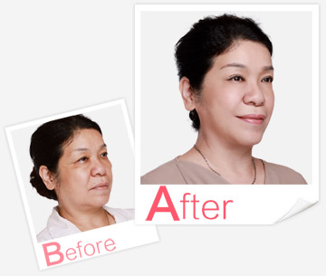 產(chǎn)后康復(fù)