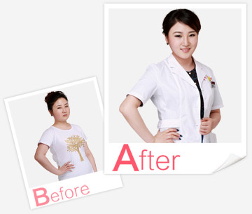 產(chǎn)后恢復(fù)